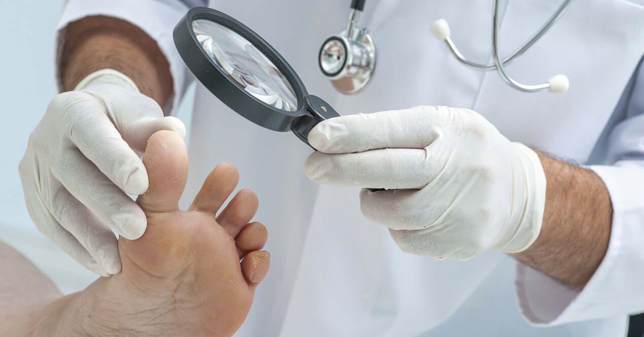 Arzt untersucht Füße auf Nagelpilz