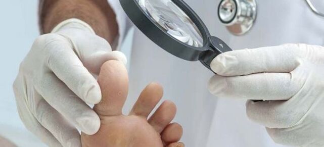 Untersuchungen vor Beginn der Pilzbehandlung