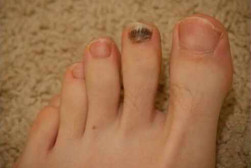 Verwendung oraler und topischer Medikamente