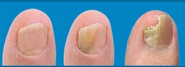 Pilzentwicklungsprozess